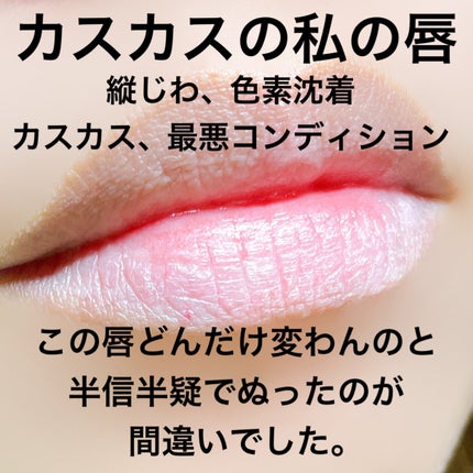 リードルSリッププランパー カラー/VT/リッププランパーを使ったクチコミ(3枚目)