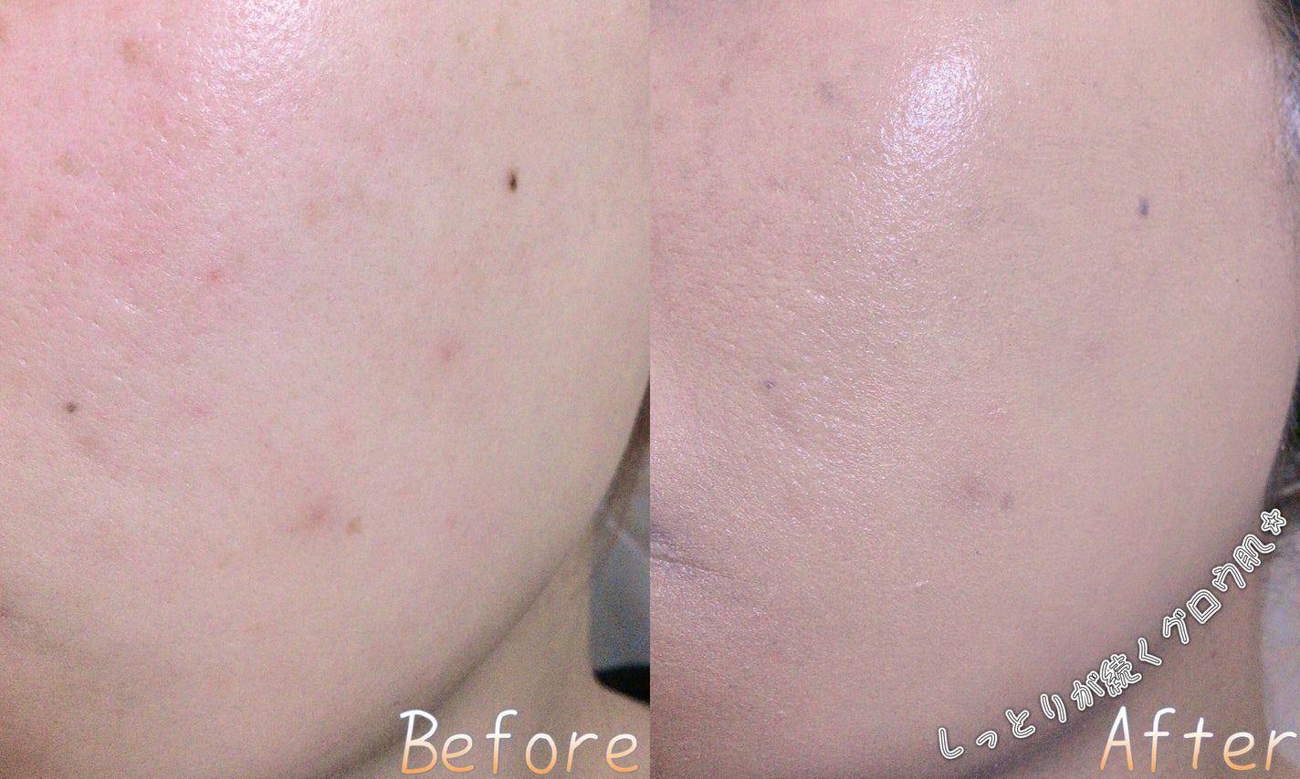 Natural Glow Cushion/Mastina/クッションファンデーションを使ったクチコミ(4枚目)