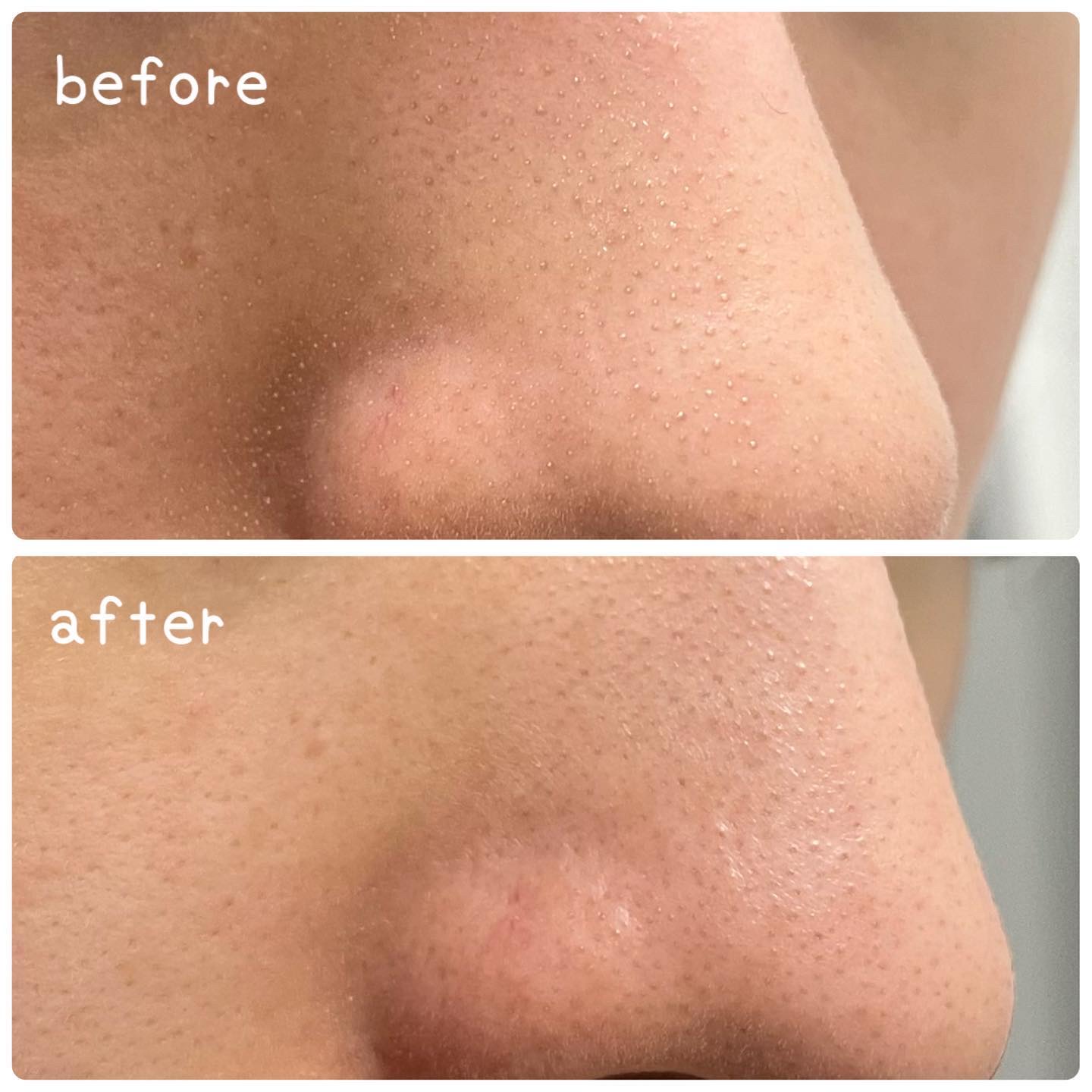 ピンククレイ酵素クレンザー/SKIN SIGNAL/洗顔パウダーを使ったクチコミ（3枚目）