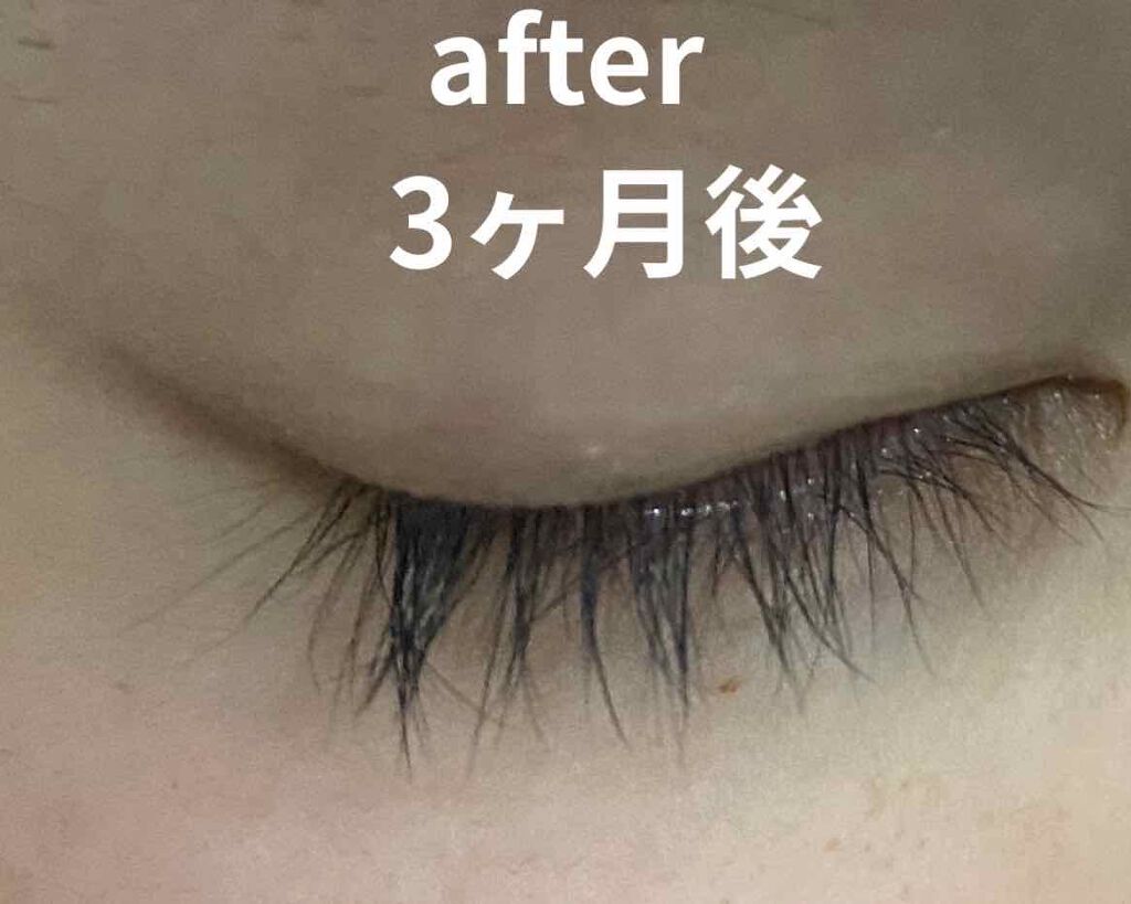 EMAKED(エマーキット)/水橋保寿堂製薬/まつげ美容液を使ったクチコミ(3枚目)