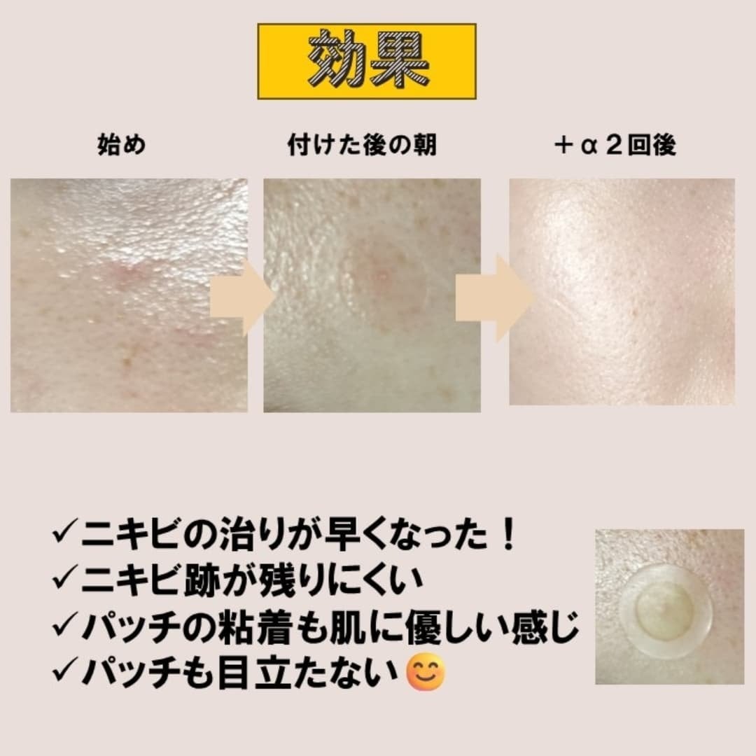 スポットイレイザー/NOLAHOUR/その他スキンケアを使ったクチコミ(3枚目)