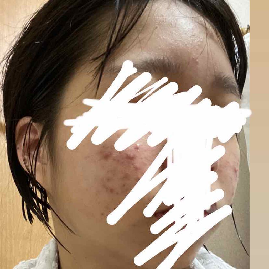 明色美顔水 薬用化粧水/美顔/化粧水を使ったクチコミ(2枚目)