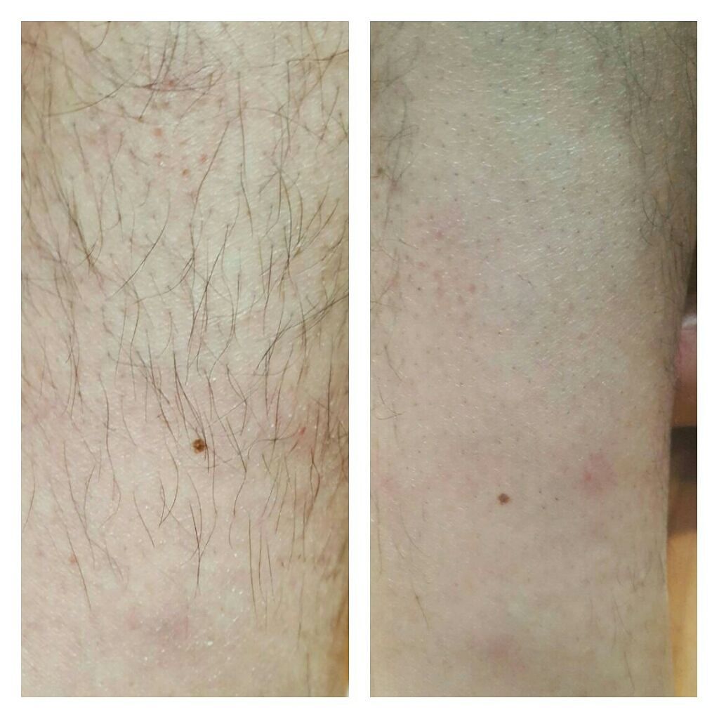 ブラックフォーム/Silky Remover/ボディサプリメントを使ったクチコミ（3枚目）