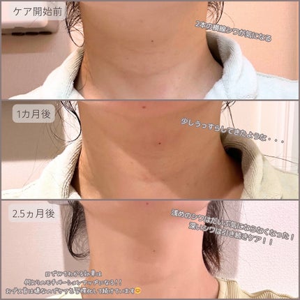 WHITE VEIL Premium/WHITE VEIL/美容サプリメントを使ったクチコミ(8枚目)