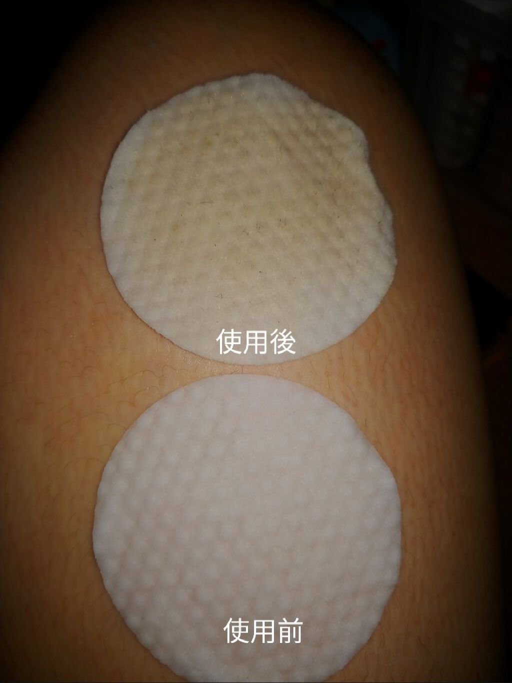 ゼロ毛穴パッド 2.0/MEDICUBE/トナーパッドを使ったクチコミ（2枚目）