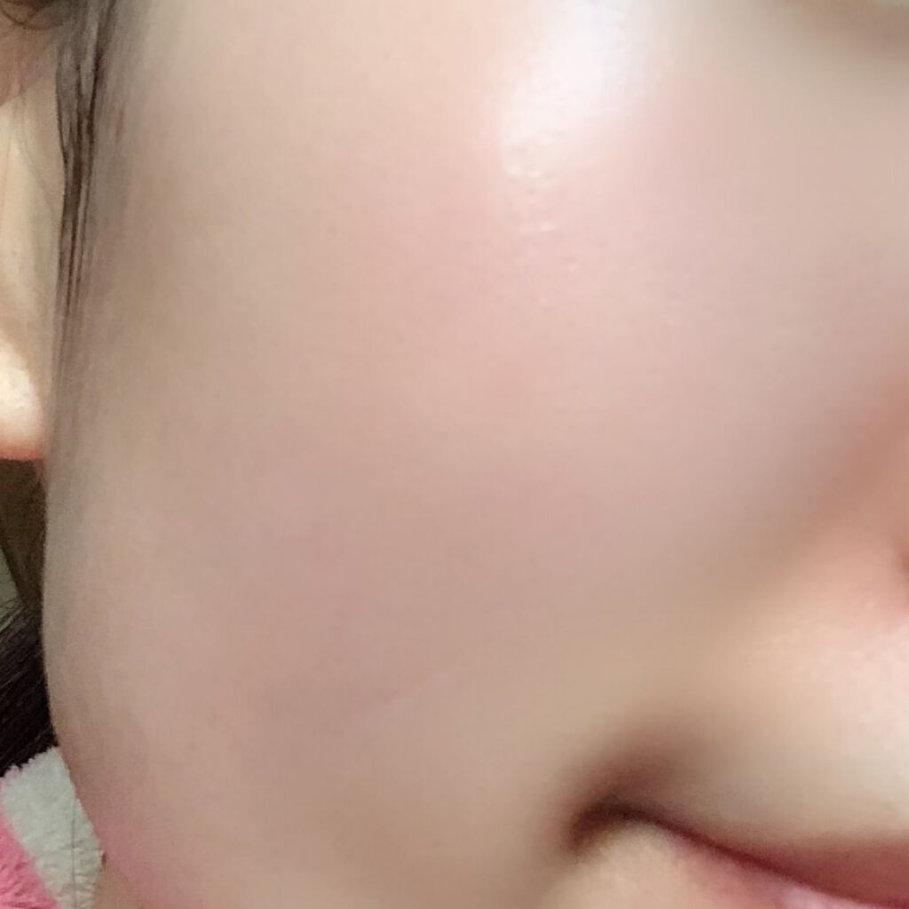 オバジX リフトローション/オバジ/化粧水を使ったクチコミ(3枚目)