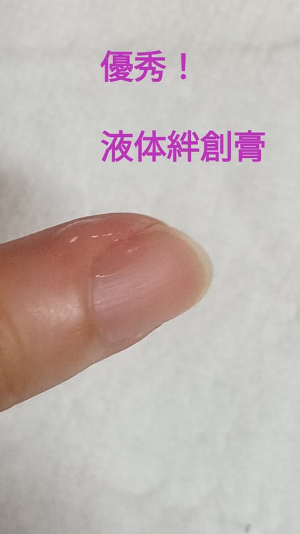 コロスキン(医薬品)/東京甲子社/その他を使ったクチコミ(1枚目)
