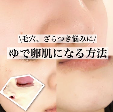 yuna＊＊ on LIPS 「ざらつきオフしてゆで卵肌へ🥚/たるみ、くすみ、毛穴、乾燥あらゆ..」（1枚目）