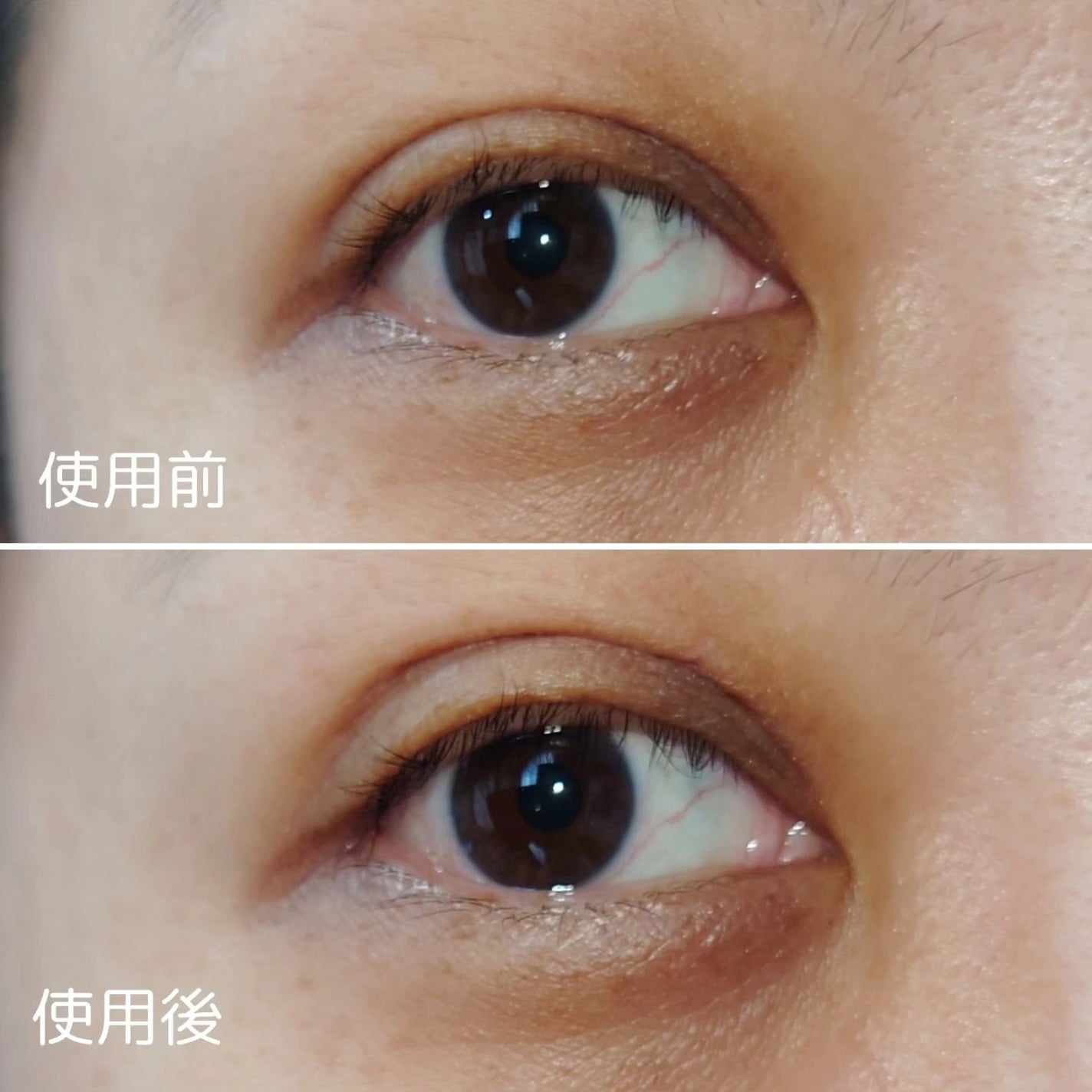 ワンダーアイリッドテープ Extra/D-UP/二重まぶた用アイテムを使ったクチコミ(6枚目)