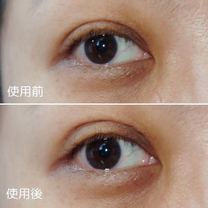 ワンダーアイリッドテープ Extra/D-UP/二重まぶた用アイテムを使ったクチコミ(6枚目)