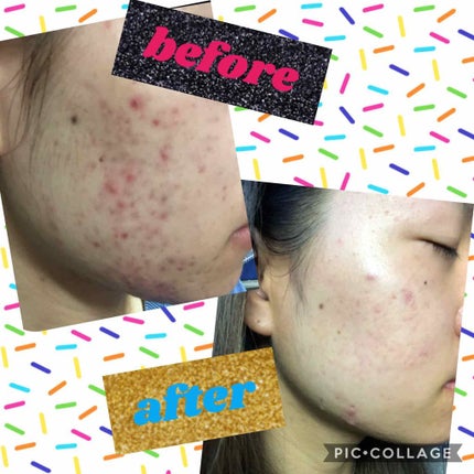 エイジングケア高保湿クリーム/無印良品/フェイスクリームを使ったクチコミ(1枚目)