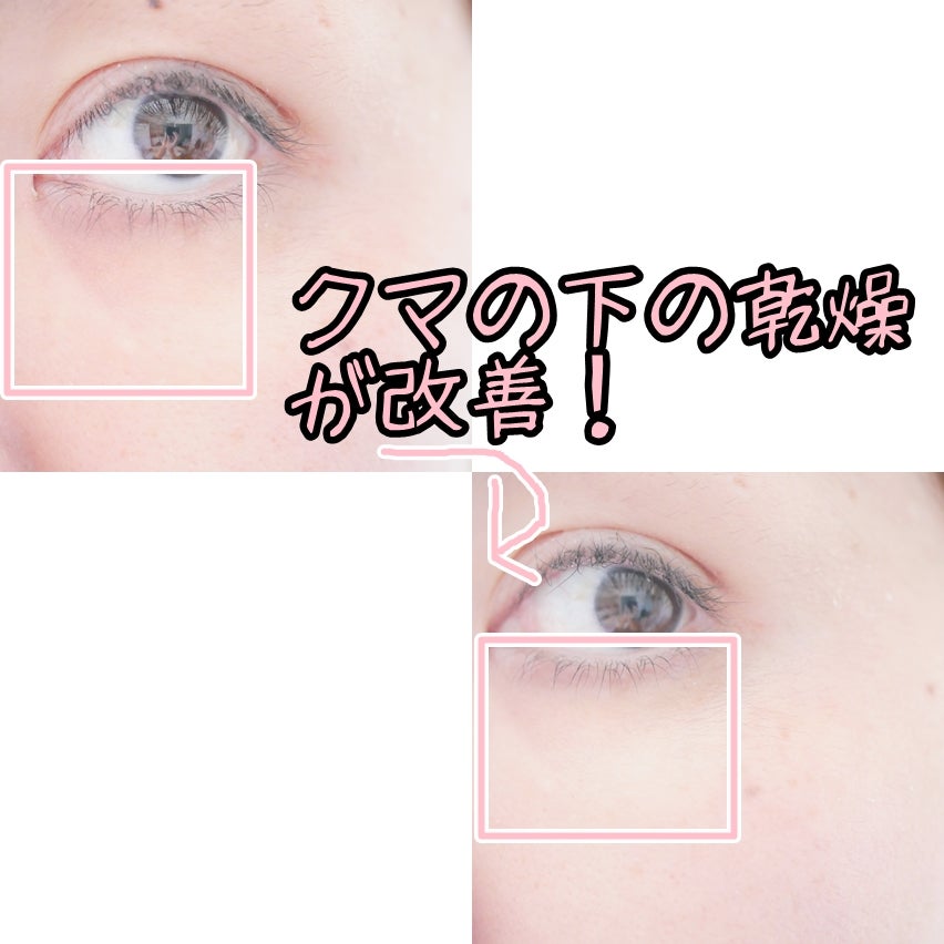 モイストゲルホワイト/Re dermalab/オールインワン化粧品を使ったクチコミ(5枚目)