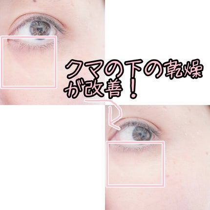 モイストゲルホワイト/Re dermalab/オールインワン化粧品を使ったクチコミ(5枚目)