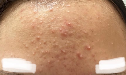 ð§ð»ãããïŒãããè·¡æ²æ»
âð»âª on LIPS ãèèãæ¥èšâ€æµç³ã«ãã°ããã®é¡ã ããããåŠæ ¡ã«ããããªããðæ©..ãïŒ4æç®ïŒ