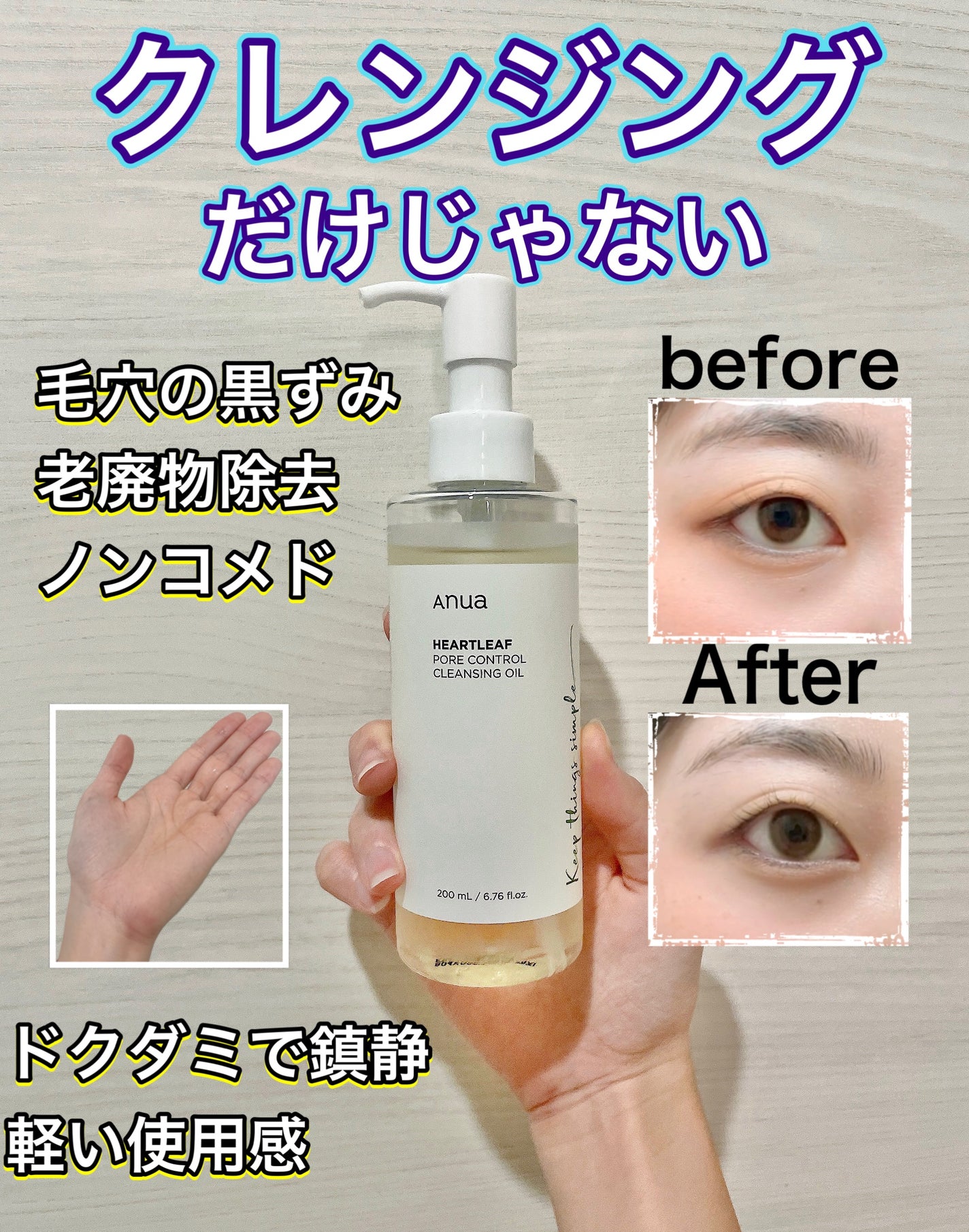 ドクダミ ポアコントロールクレンジングオイル/Anua/オイルクレンジングを使ったクチコミ(1枚目)