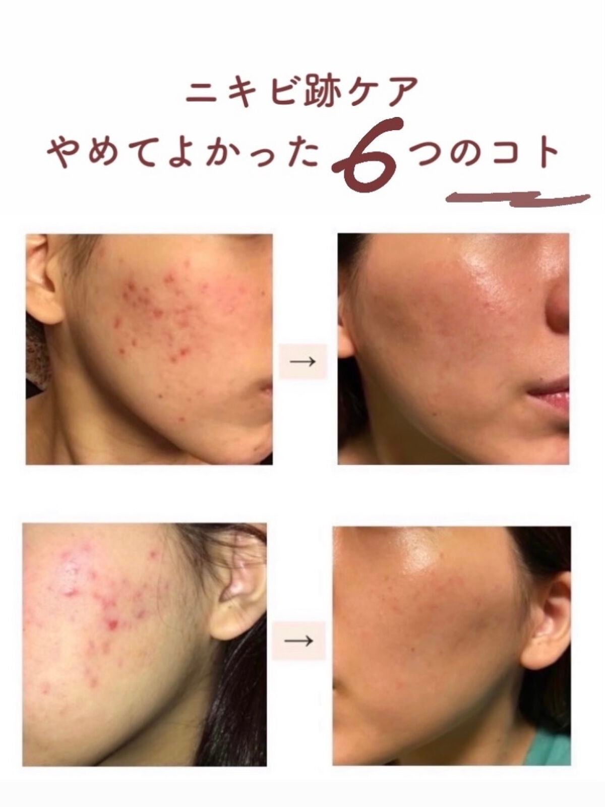 yuyuð¶èèãäœè³ªã®æ£çŽã¬ãã¥ãŒ on LIPS ãããããè·¡ã±ã¢ð¥ãããŠããã£ã6ã€ã®ã³ããâŒâ¢â¢âââ¢â¢âŒâ¢â¢..ãïŒ1æç®ïŒ