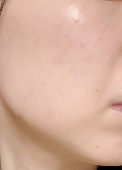 薬用しみ対策 美白乳液【医薬部外品】/メラノCC/乳液を使ったクチコミ(3枚目)