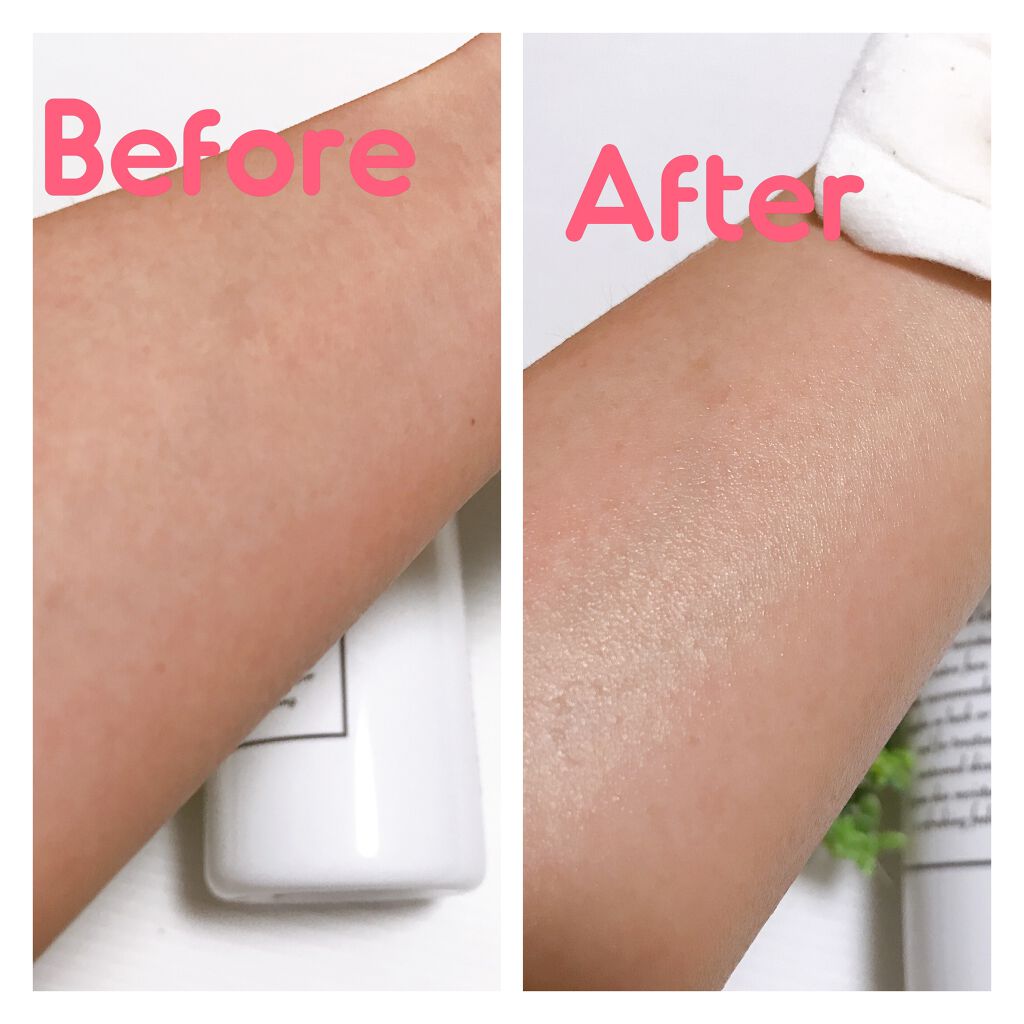 薬用スキンコンディショナー/オードメディカ/ボディローションを使ったクチコミ(3枚目)