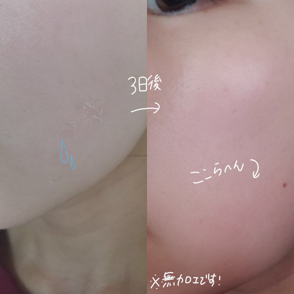 プロポリス エネルギーアンプル/CNP Laboratory/美容液を使ったクチコミ(2枚目)