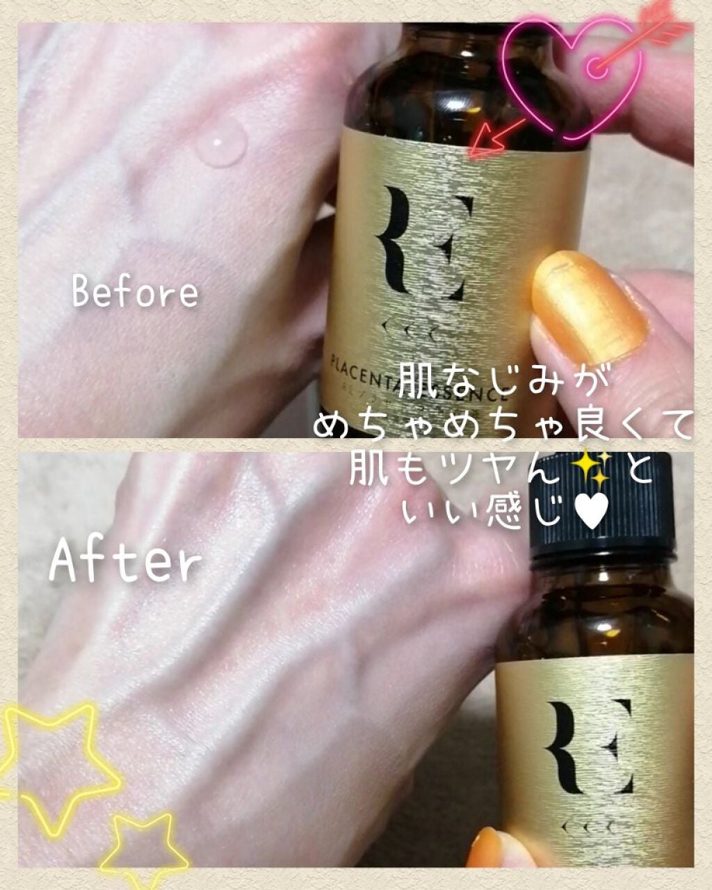 REプラセンタ美容液/RE(アール・イー)/美容液を使ったクチコミ(6枚目)