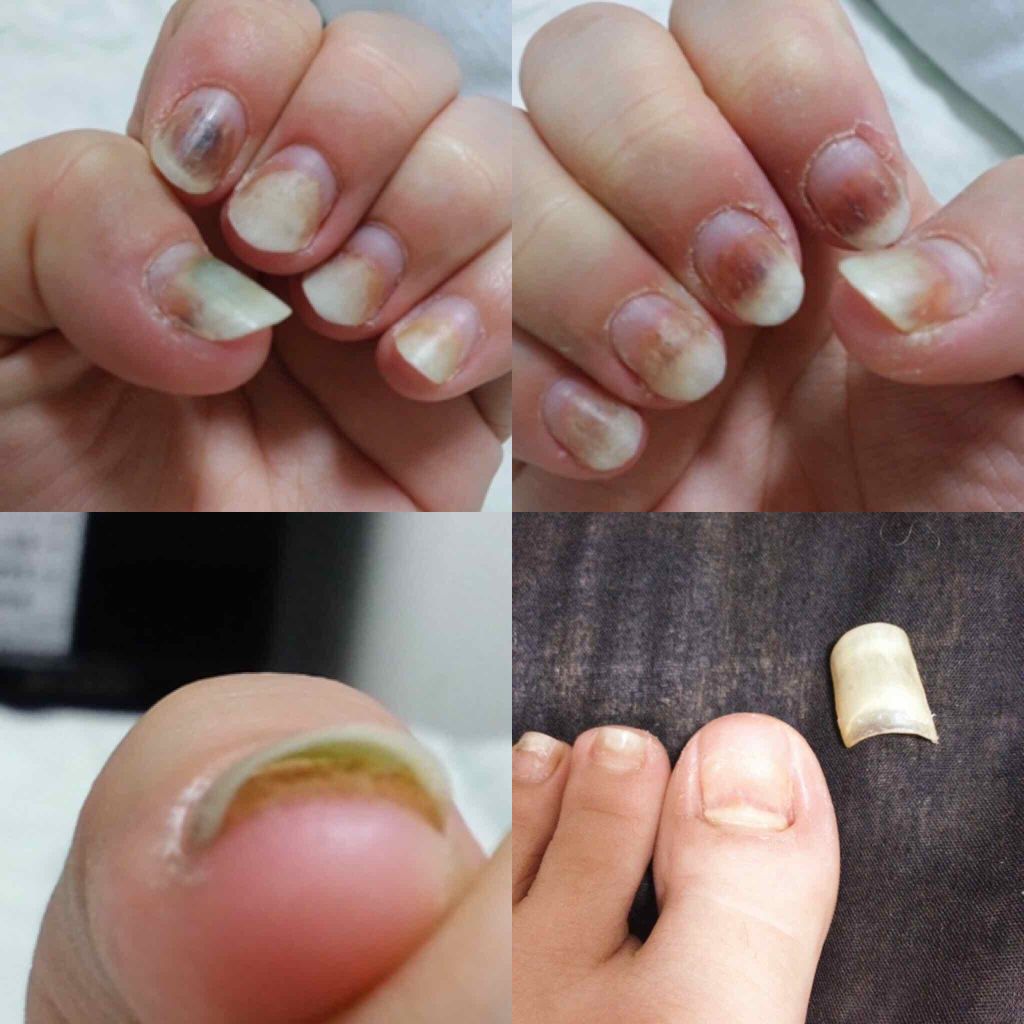 ディープセラム/Dr.Nail/ネイルオイル・トリートメントを使ったクチコミ(2枚目)