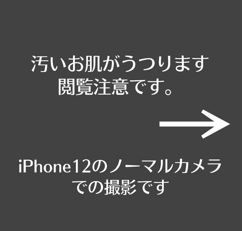 オードムーゲ 薬用ローション(ふきとり化粧水)/オードムーゲ/拭き取り化粧水を使ったクチコミ(2枚目)