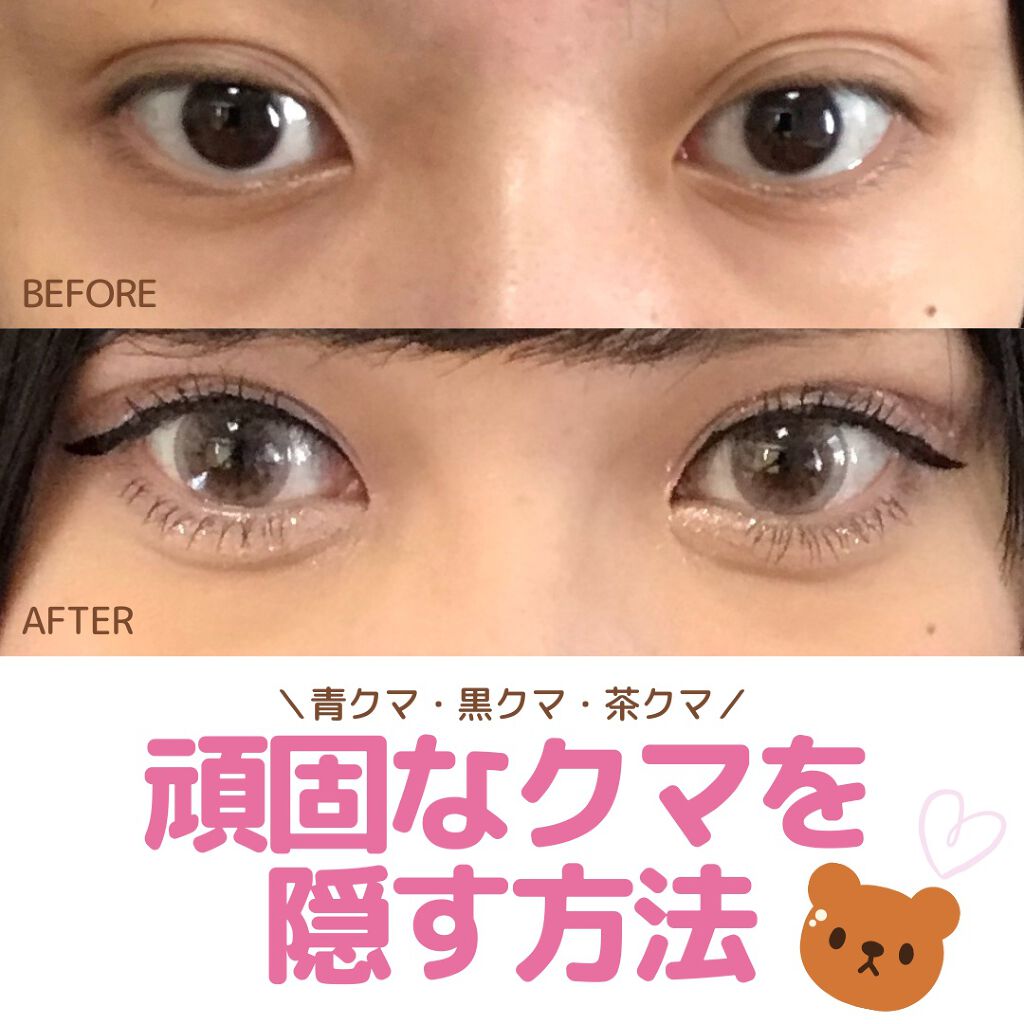 ラディアント タッチ Yves Saint Laurent Beauteを使った口コミ 今回は常に目の下にどデカいクマを飼っている By たまのみこと 敏感肌 代後半 Lips