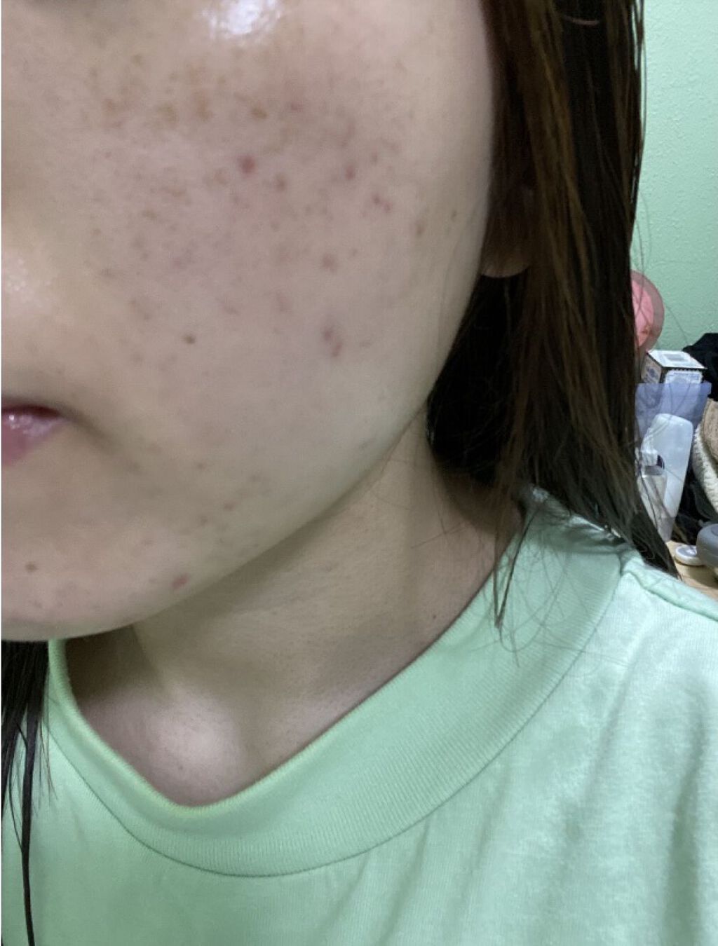 ブライト＆バウンシングローション（ミスト）/ジュレリッチ/ミスト状化粧水を使ったクチコミ（3枚目）