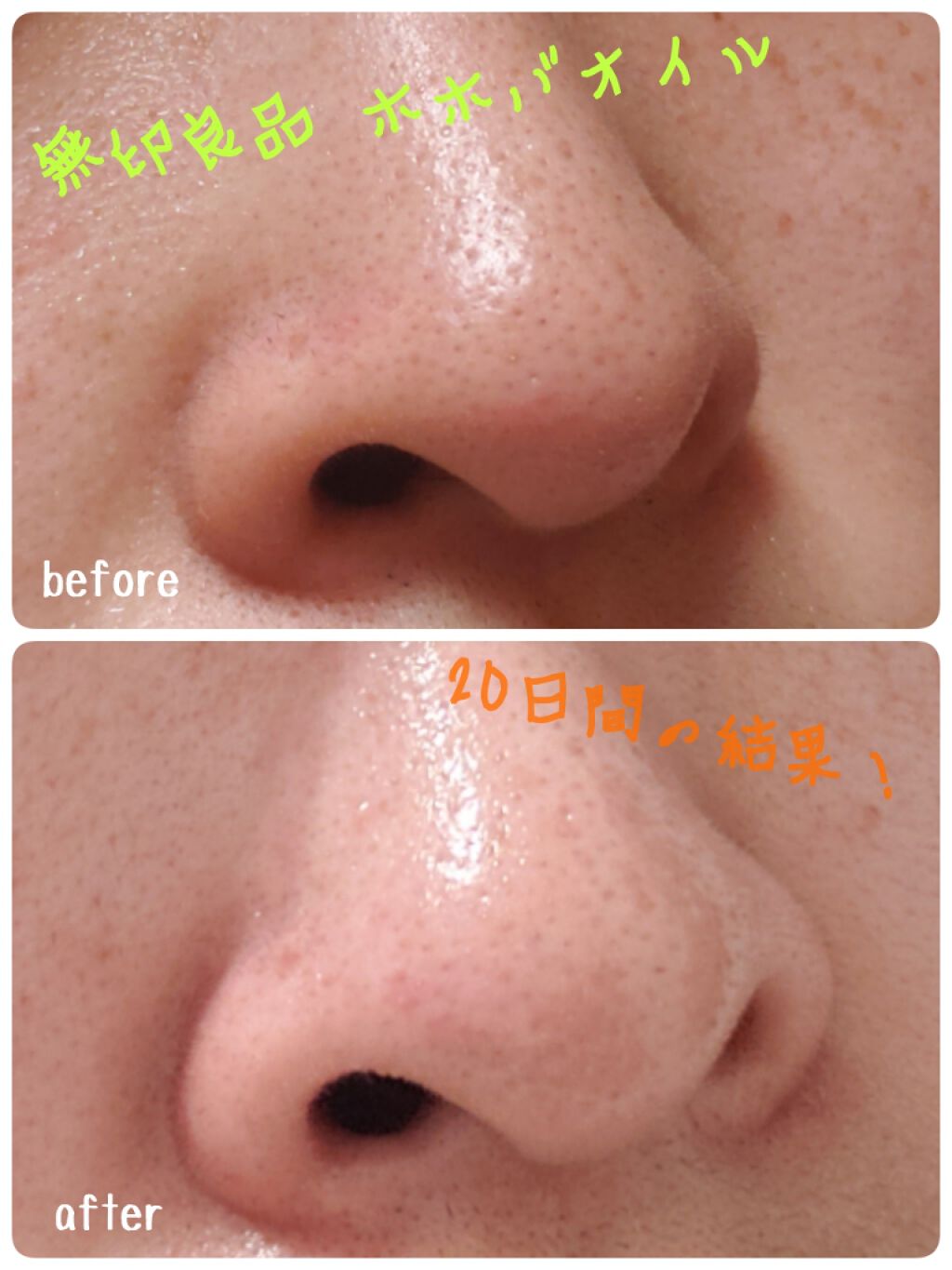 ホホバオイル/無印良品/ボディオイルを使ったクチコミ(1枚目)