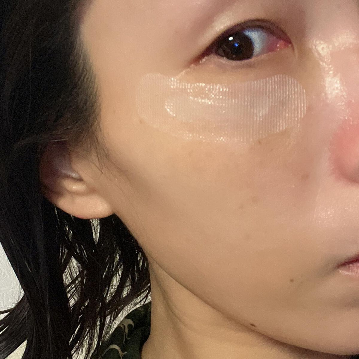 クリアターン ヒアロチューン マイクロパッチ 1500/クリアターン/シートマスク・パックを使ったクチコミ(5枚目)