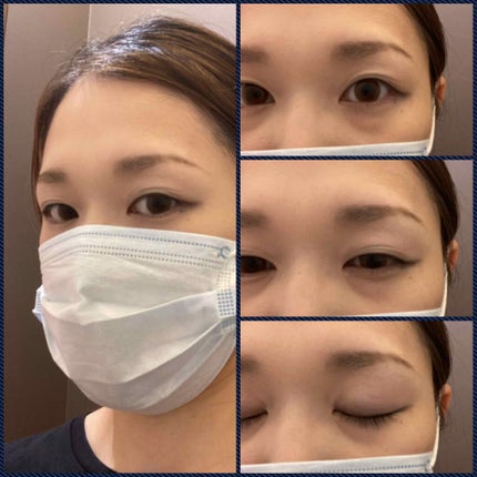 ナチュラル チークN/CEZANNE/パウダーチークを使ったクチコミ(2枚目)