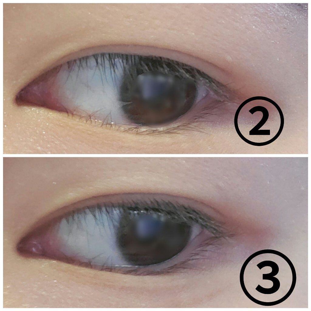 アイビューティー フィクサー WP/アストレア ヴィルゴ/二重まぶた用アイテムを使ったクチコミ（3枚目）