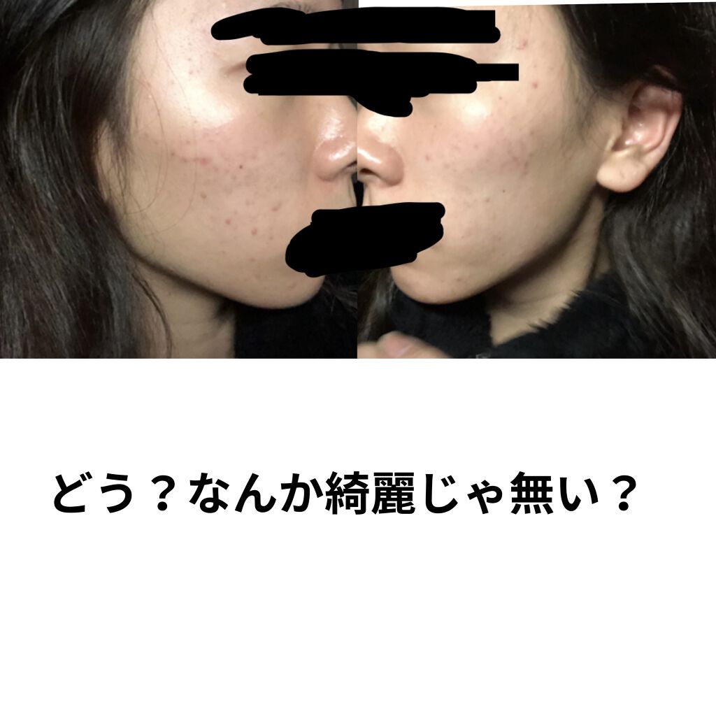 白潤 薬用美白化粧水/肌ラボ/化粧水を使ったクチコミ（2枚目）