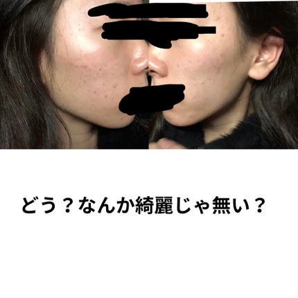 白潤 薬用美白化粧水/肌ラボ/化粧水を使ったクチコミ(2枚目)