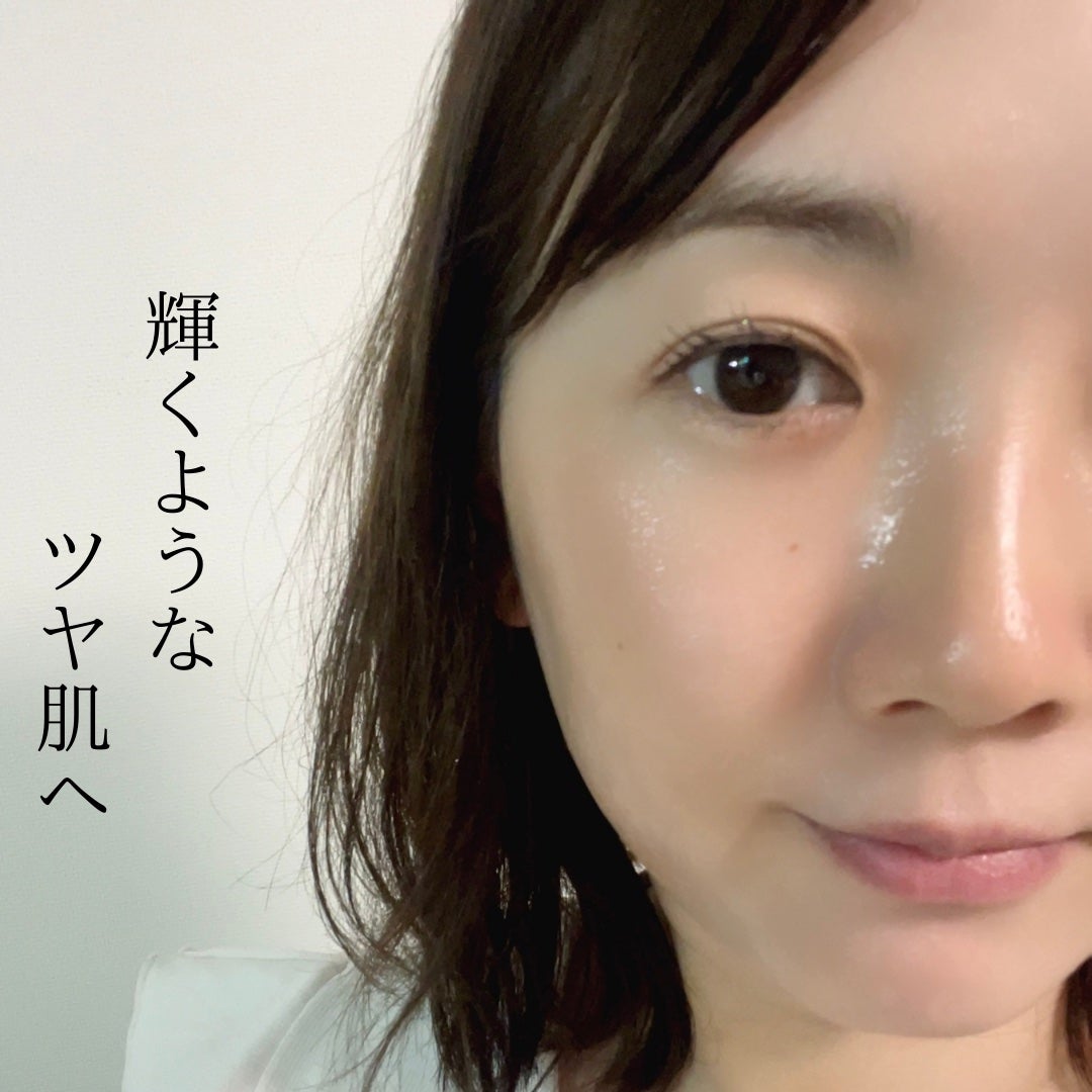 ビタペアC ビタレチ美容液/ネイチャーリパブリック/美容液を使ったクチコミ(4枚目)