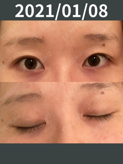 ルドゥーブル/ルドゥーブル/二重まぶた用アイテムを使ったクチコミ(5枚目)