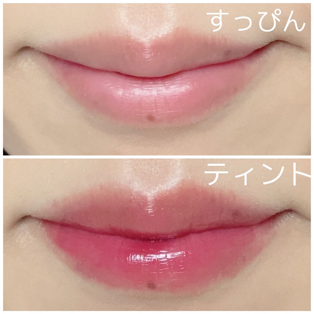 ヒビプロLP(医薬品)/メンソレータム/その他を使ったクチコミ（3枚目）