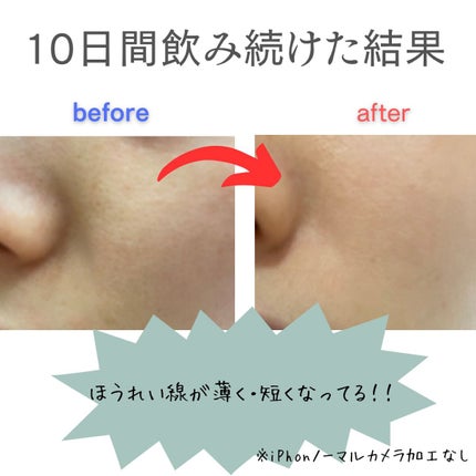 ザ・コラーゲン <ドリンク>/ザ・コラーゲン/美容サプリメントを使ったクチコミ(5枚目)