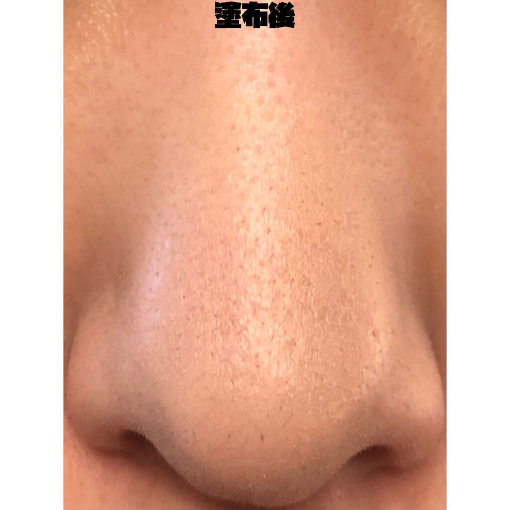 フローレス フィット/COVERMARK/クリーム・エマルジョンファンデーションを使ったクチコミ(3枚目)