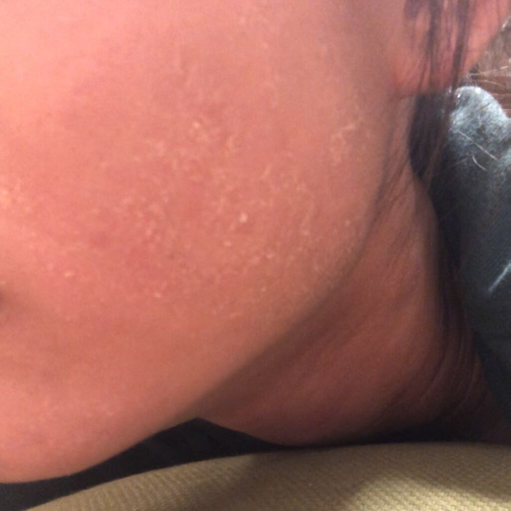 ミノン アミノモイスト ぷるぷるしっとり肌マスク/ミノン/シートマスク・パックを使ったクチコミ（3枚目）