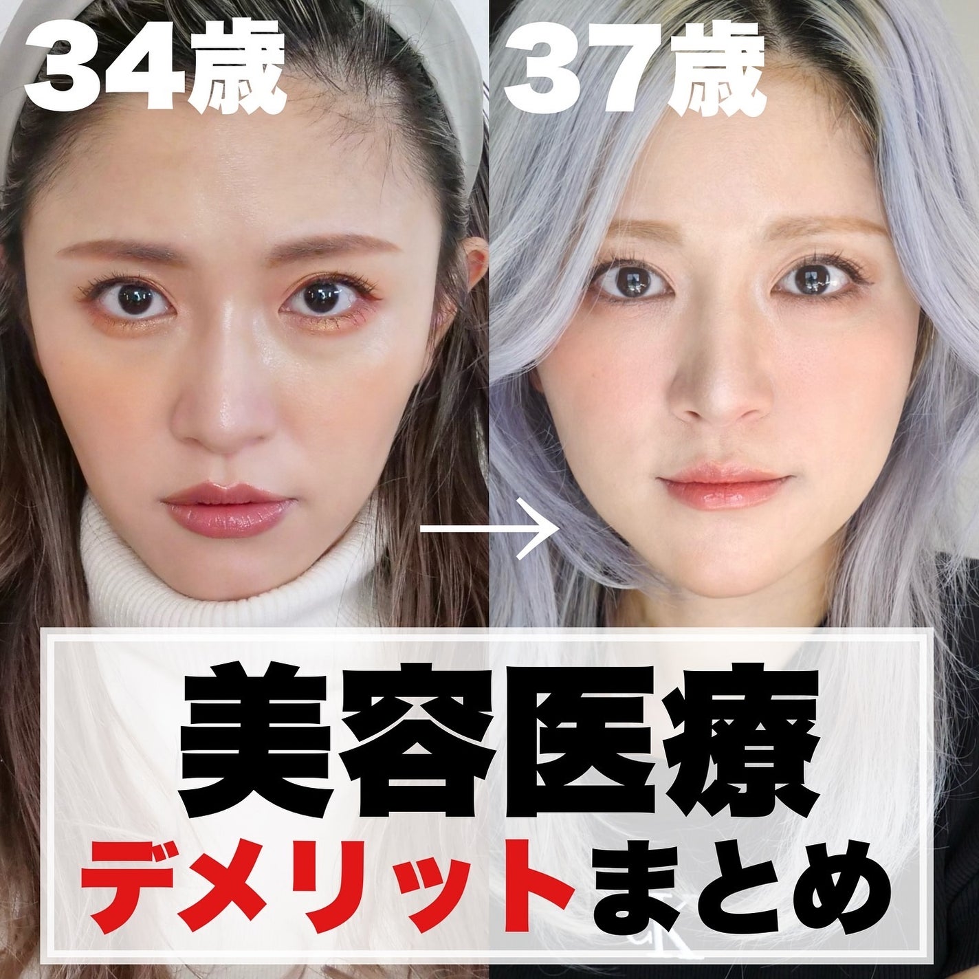 とみりー on LIPS 「美容医療デメリット詳細↓過去にやってきた美容医療のメリットは..」(1枚目)