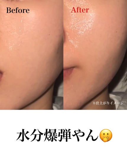 epime prepare serum #02/FABIUS/美容液を使ったクチコミ(4枚目)