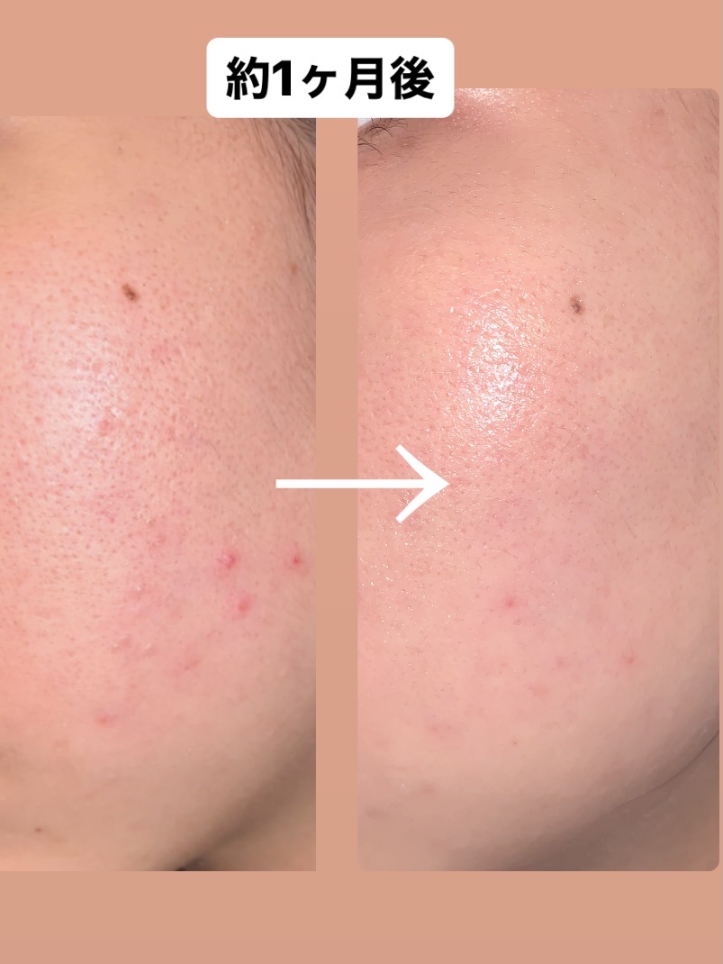 ミルクブライトニングトナー/MEDIHEAL/化粧水を使ったクチコミ（1枚目）