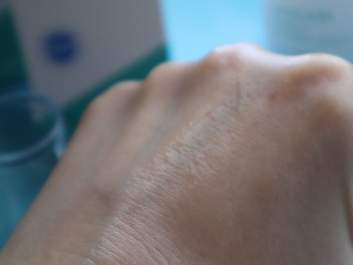 エイシカ365 ブレミッシュカーミングセラム/AESTURA/美容液を使ったクチコミ(3枚目)