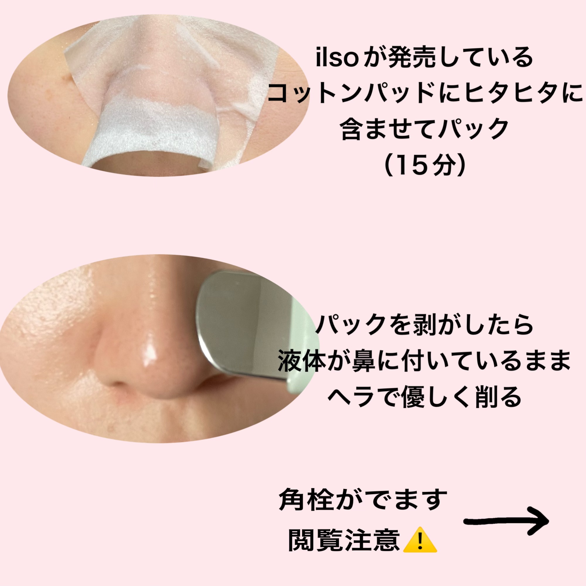 ディープクリーンマスター/ilso/その他スキンケアグッズを使ったクチコミ（2枚目）