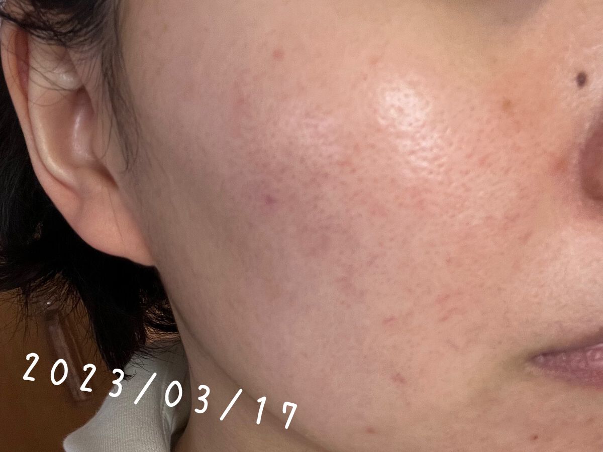 マジックカタツムリクリーム/ブラン/フェイスクリームを使ったクチコミ(3枚目)