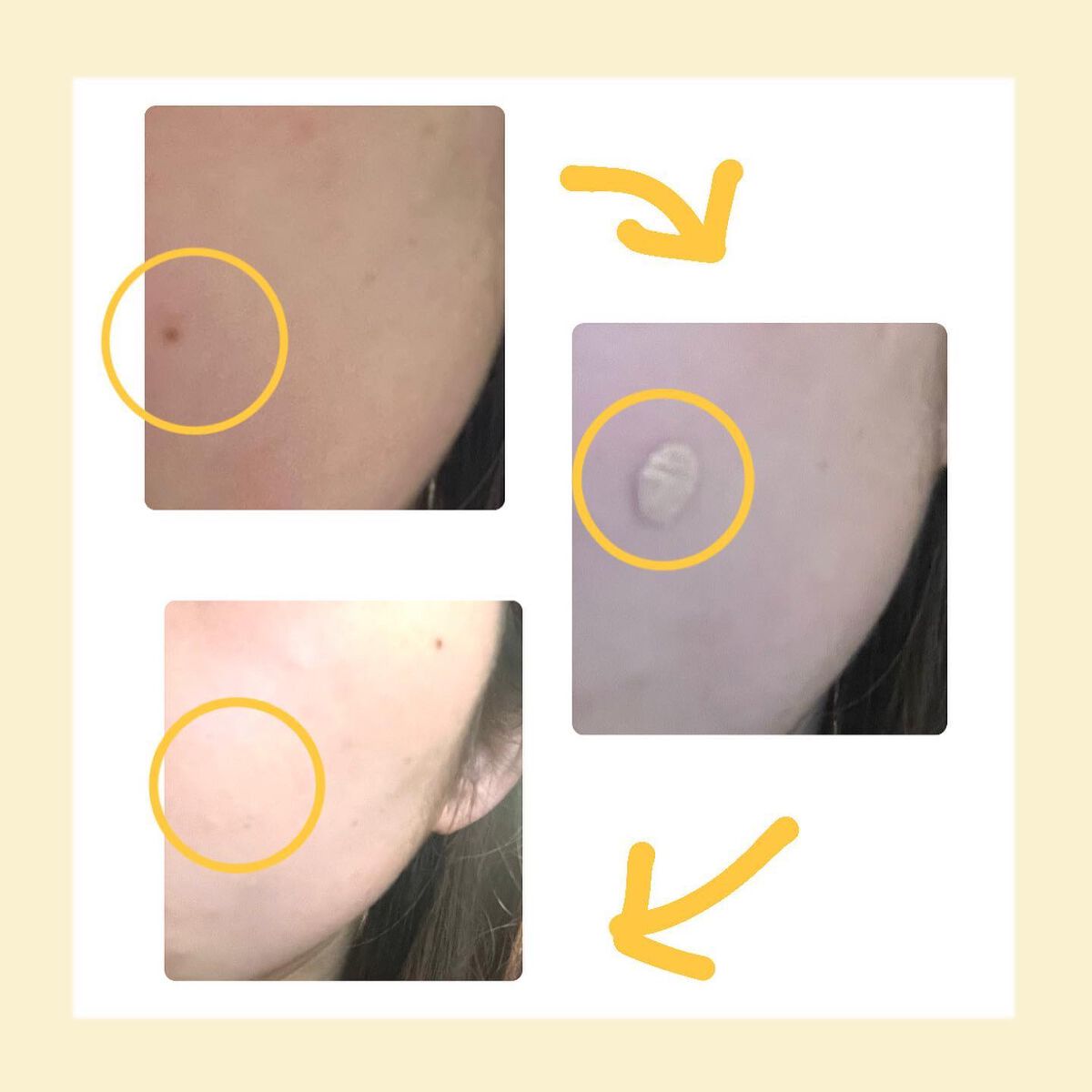 マスクフィットオールカバーデュアルコンシーラー/TIRTIR(ティルティル)/コンシーラーを使ったクチコミ（3枚目）