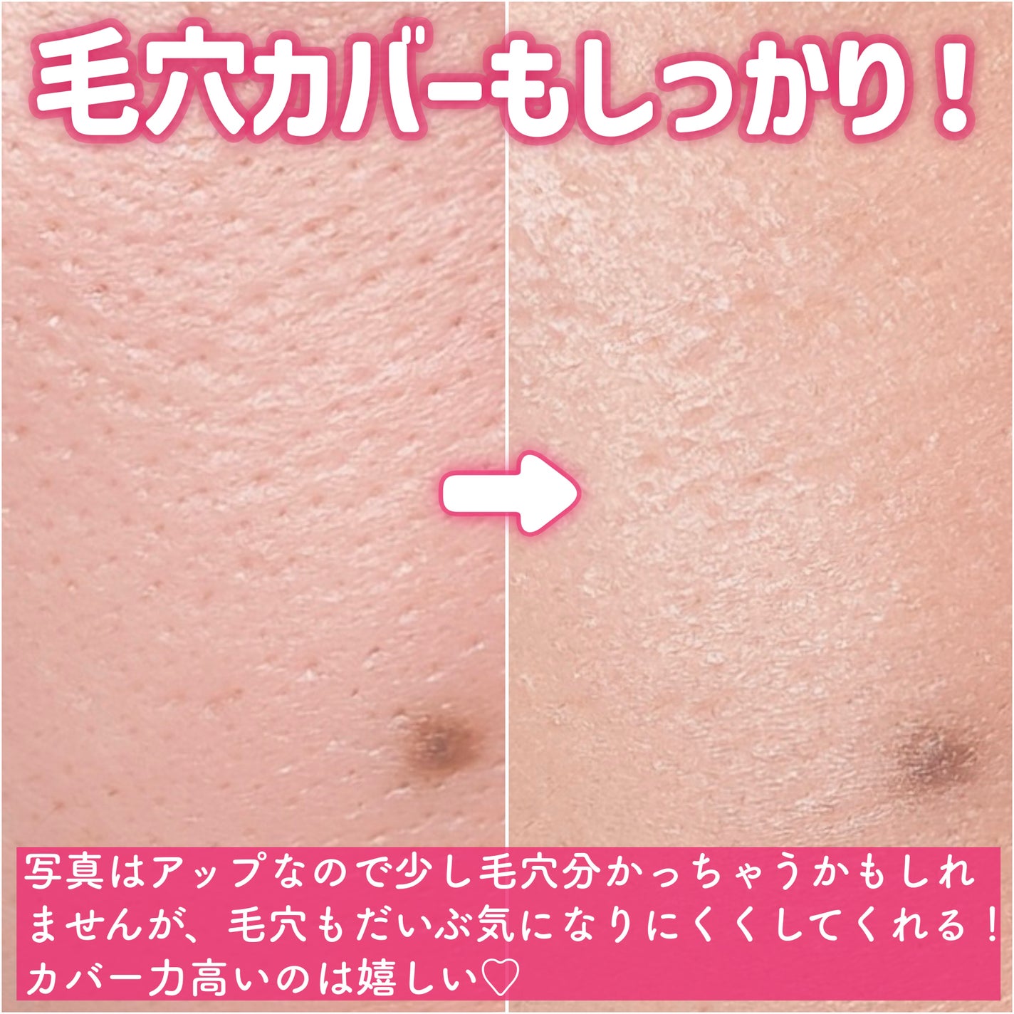 カバーリシャス アルティメット ホワイトクッション/BANILA CO/クッションファンデーションを使ったクチコミ(6枚目)