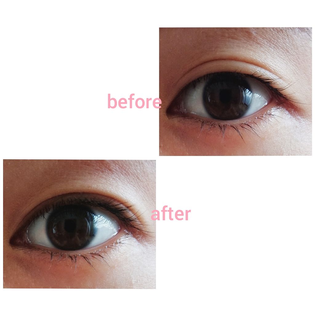 アイトーク/アイトーク/二重まぶた用アイテムを使ったクチコミ(2枚目)