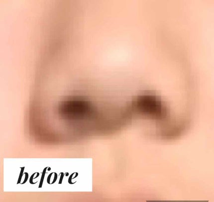 ハトムギ保湿ジェル(ナチュリエ スキンコンディショニングジェル)/ナチュリエ/美容液を使ったクチコミ(2枚目)